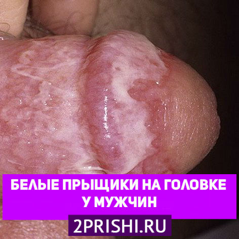 замечательный Порно фото в вагину допускаете ошибку. Давайте обсудим