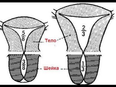 Uterus was bedeutet plumper Was heißt