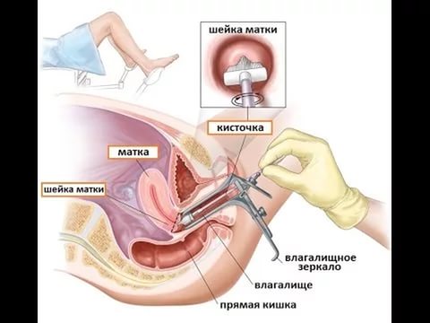 Gebärmutterentfernung sex nach feiperwildlins: Sex