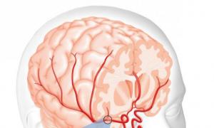 Енцефалопатія головного мозку у літніх: причини появи недуги, симптоми та лікування