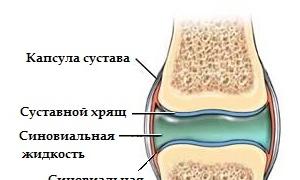 Відкачування рідини з колінного суглоба - як відбувається процедура?