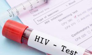 Diagnosi di VIL: cosa c'è da sapere sui test