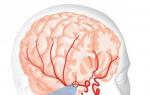 Енцефалопатія головного мозку у літніх: причини появи недуги, симптоми та лікування
