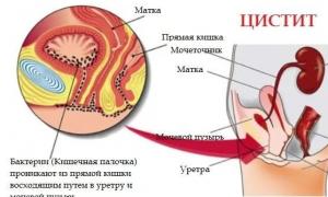 Причини болю внизу живота у жінок (ліворуч, праворуч), лікування патології